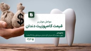 عوامل مؤثر بر قیمت کامپوزیت دندان