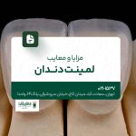 مزایا و معایب لمینت دندان