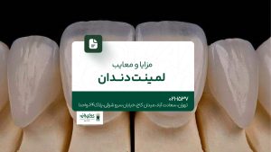 مزایا و معایب لمینت دندان